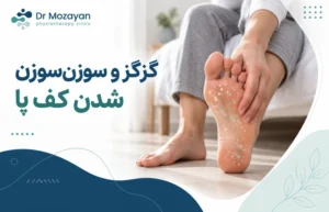 علت گزگز کف پا - علت سوزن سوزن شدن کف پا