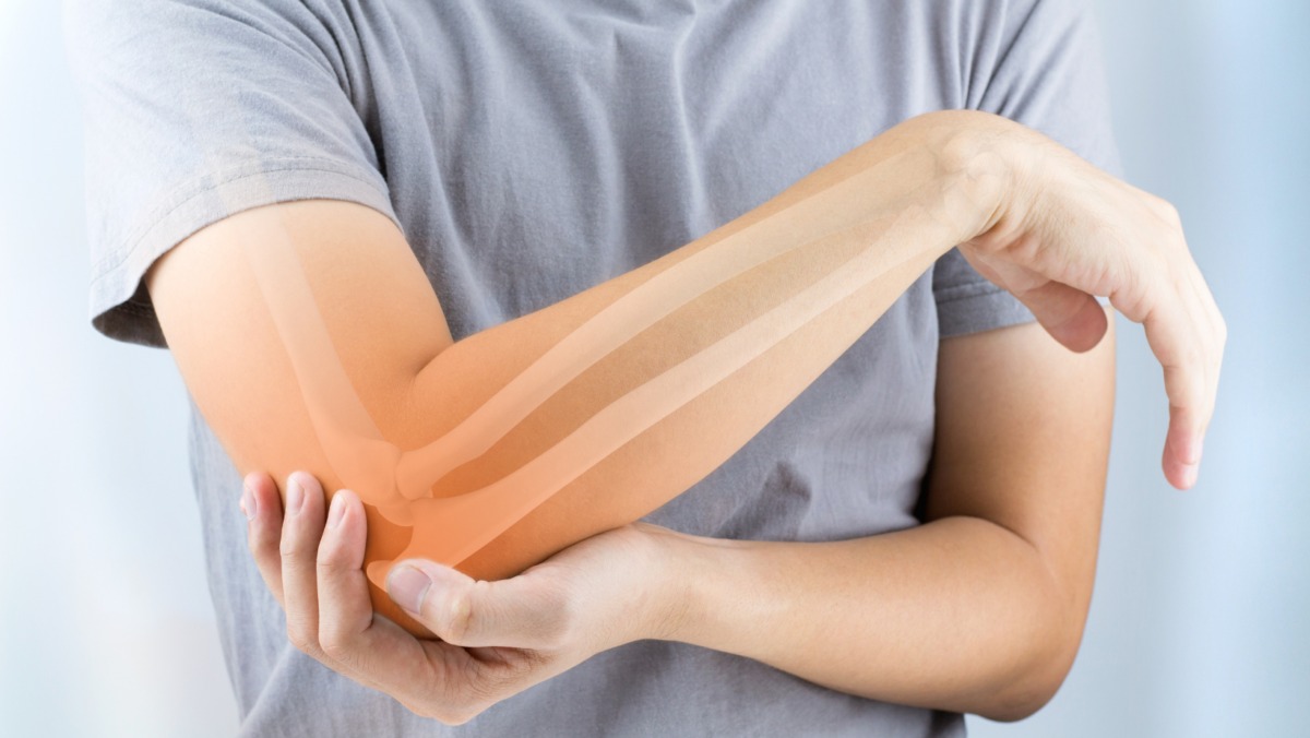 آرنج تنیس‌ بازان (Tennis Elbow) یا تنیس البو