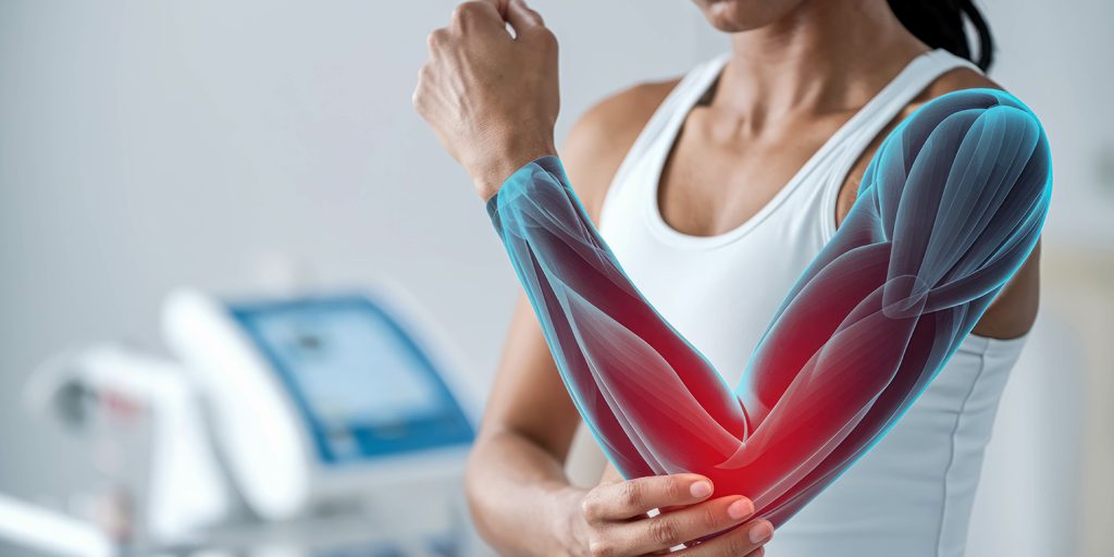 آرنج تنیس‌ بازان (Tennis Elbow) یا تنیس البو