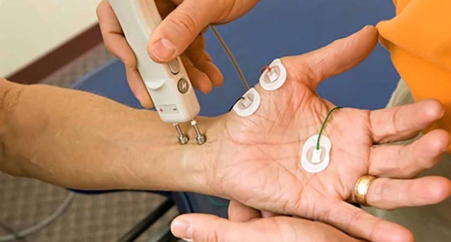 الکترومیوگرافی (EMG) و مطالعه هدایت عصبی (NCV) تشخیص تونل کارپال