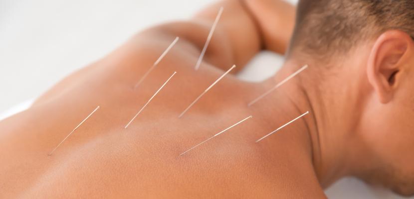 طب سوزنی چگونه باعث کاهش درد میشود؟