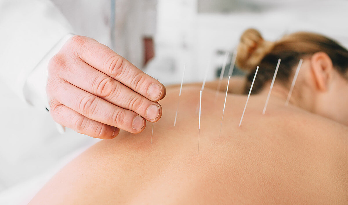 طب سوزنی چیست؟