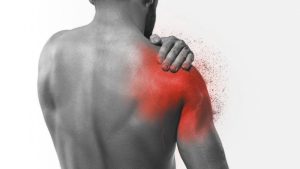 شانه یخ زده چیست | علائم و روش‌های درمان