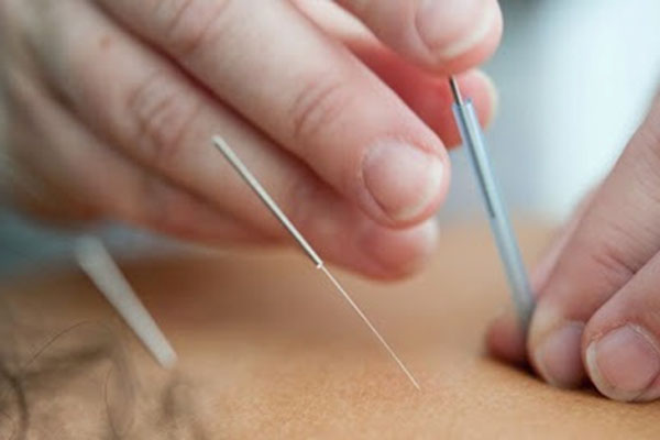 خدمات فیزیوتراپی-طب سوزنی پیشرفته