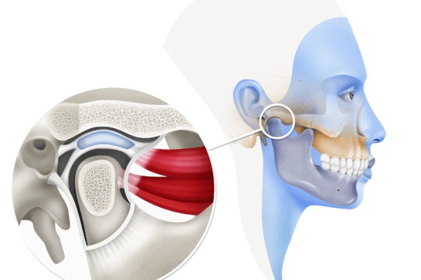 فیزیوتراپی فک و صورت