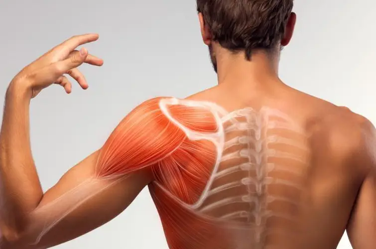 آنچه باید از بورسیت شانه بدانید