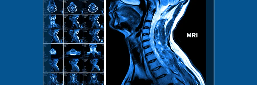 روش‌های تشخیص آرتروز گردن