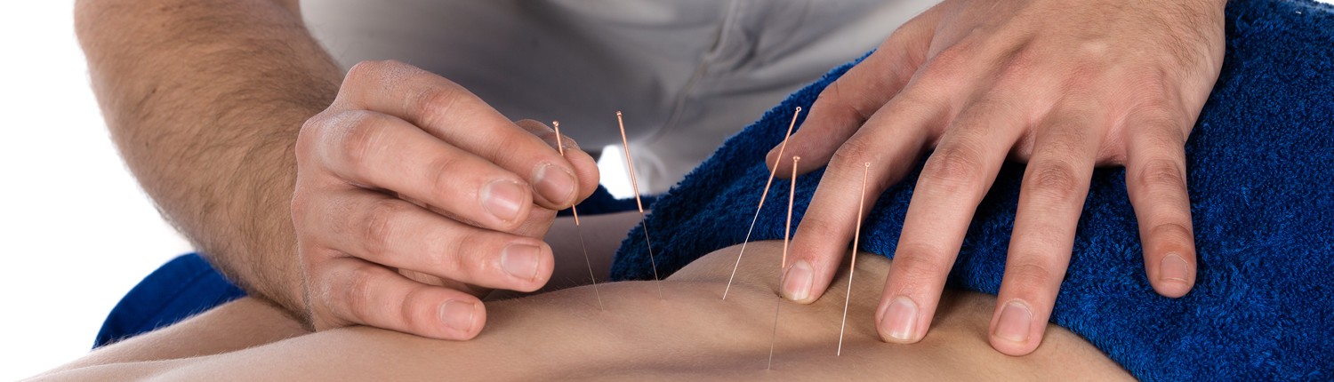 سوزن خشک یا درای نیدلینگ