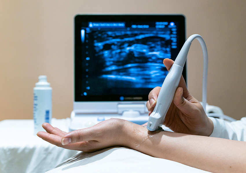 سونوگرافی تشخیص