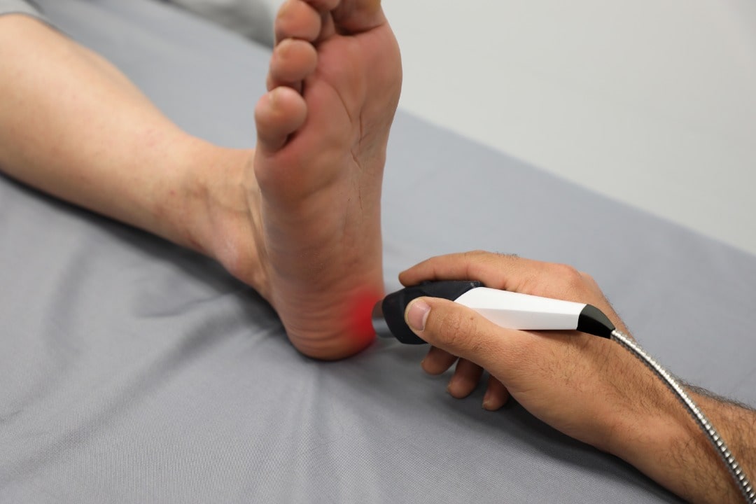 لیزر درمانی برای خار پاشنه پا