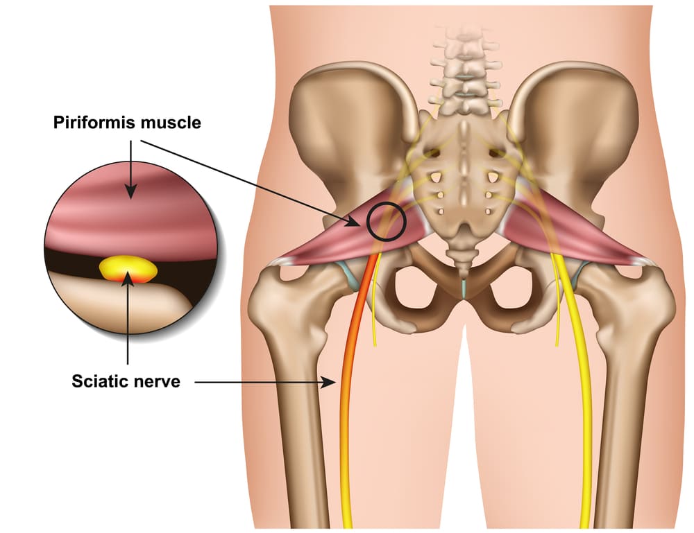 پیریفورمیس (Piriformis)