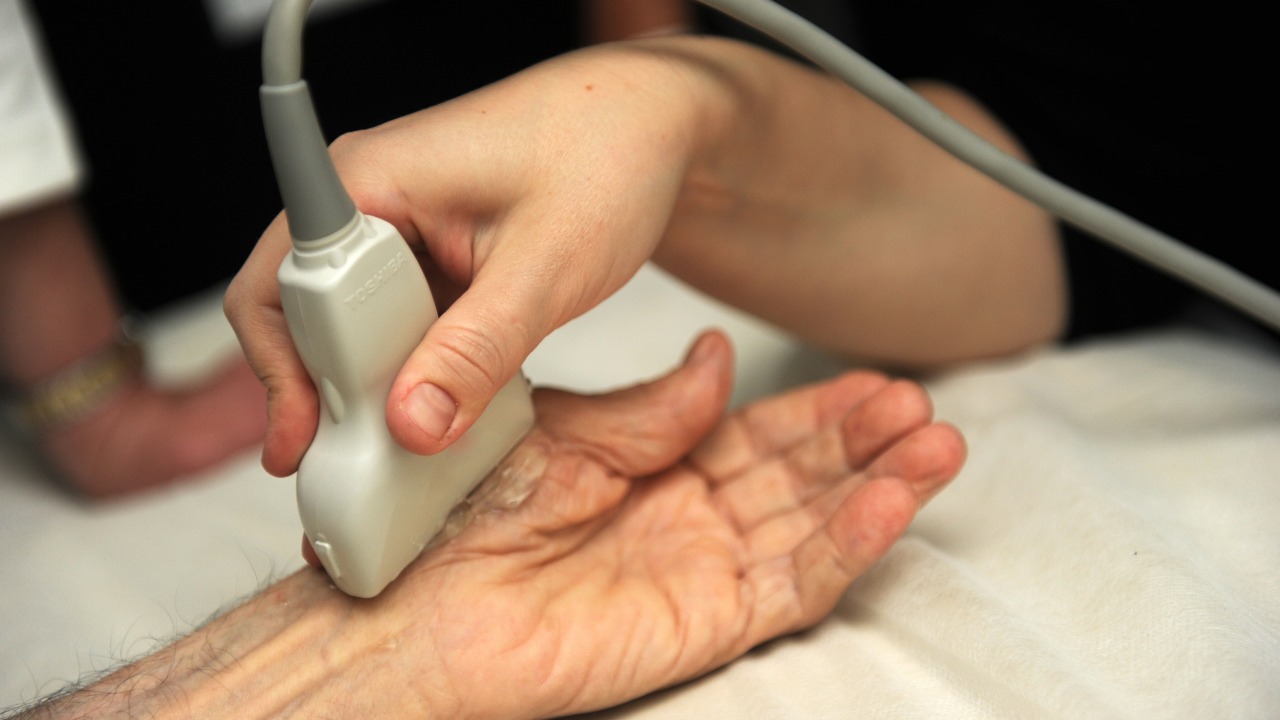 اولتراسوند تراپی در درمان درد انگشت دست