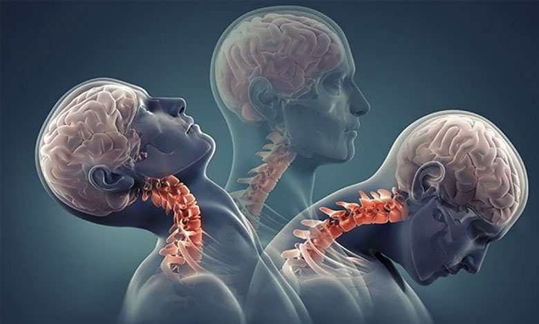 ضربه شلاقی گردن چیست؟