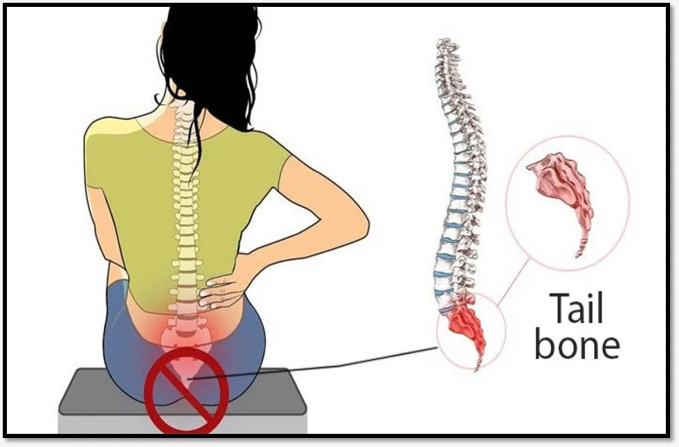 درد دنبالچه