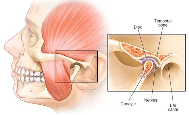مفصل گیجگاهی-فکی (TMJ)