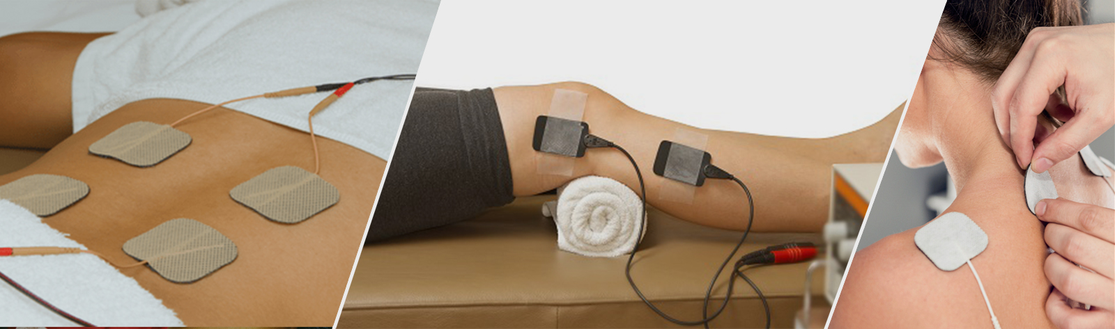 عوارض الکتروتراپی در فیزیوتراپی