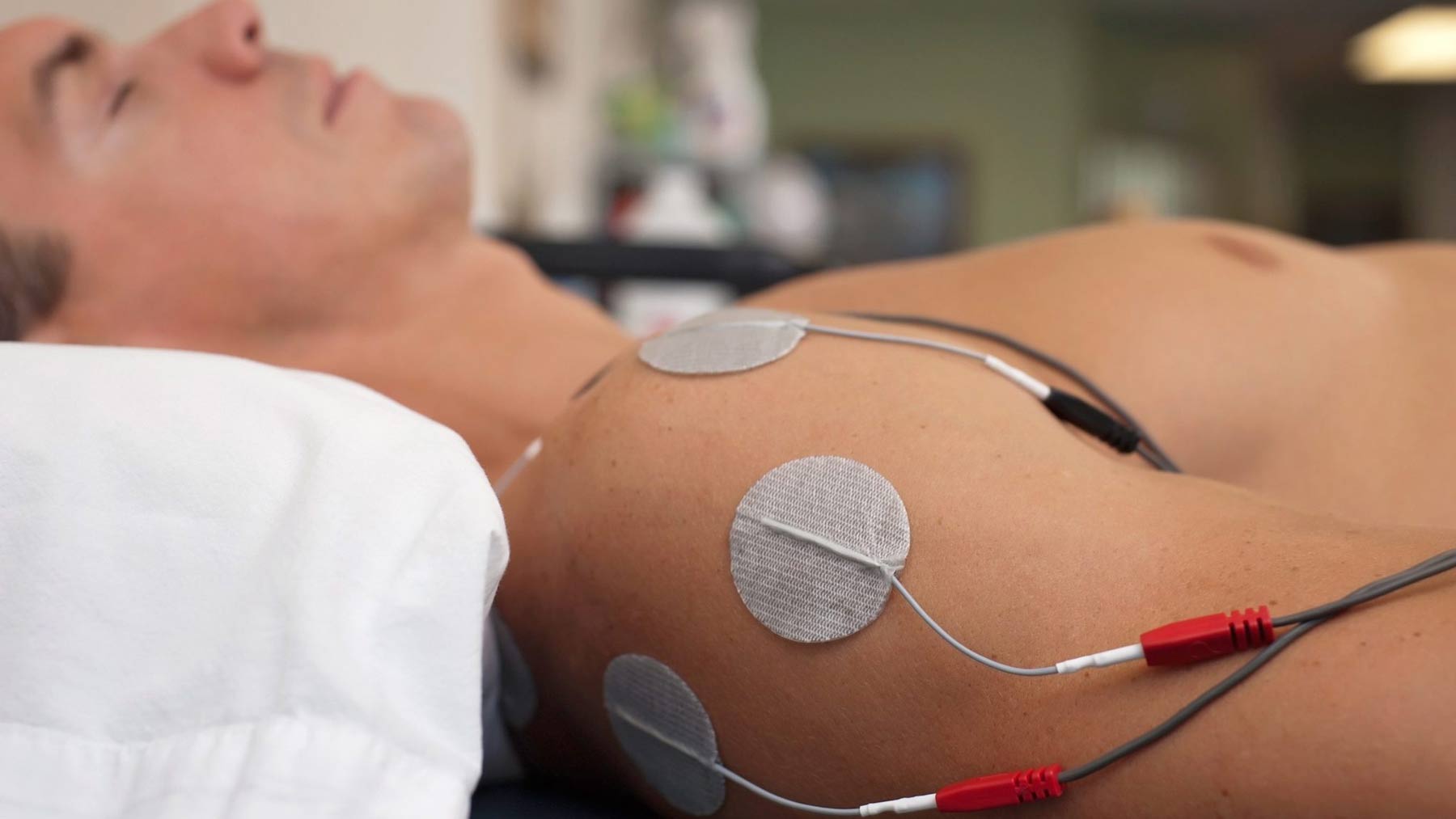 عوارض الکتروتراپی در فیزیوتراپی