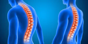 قوز کمر؛ از علت تا درمان | راهنمای کامل پیشگیری و اصلاح پوسچر