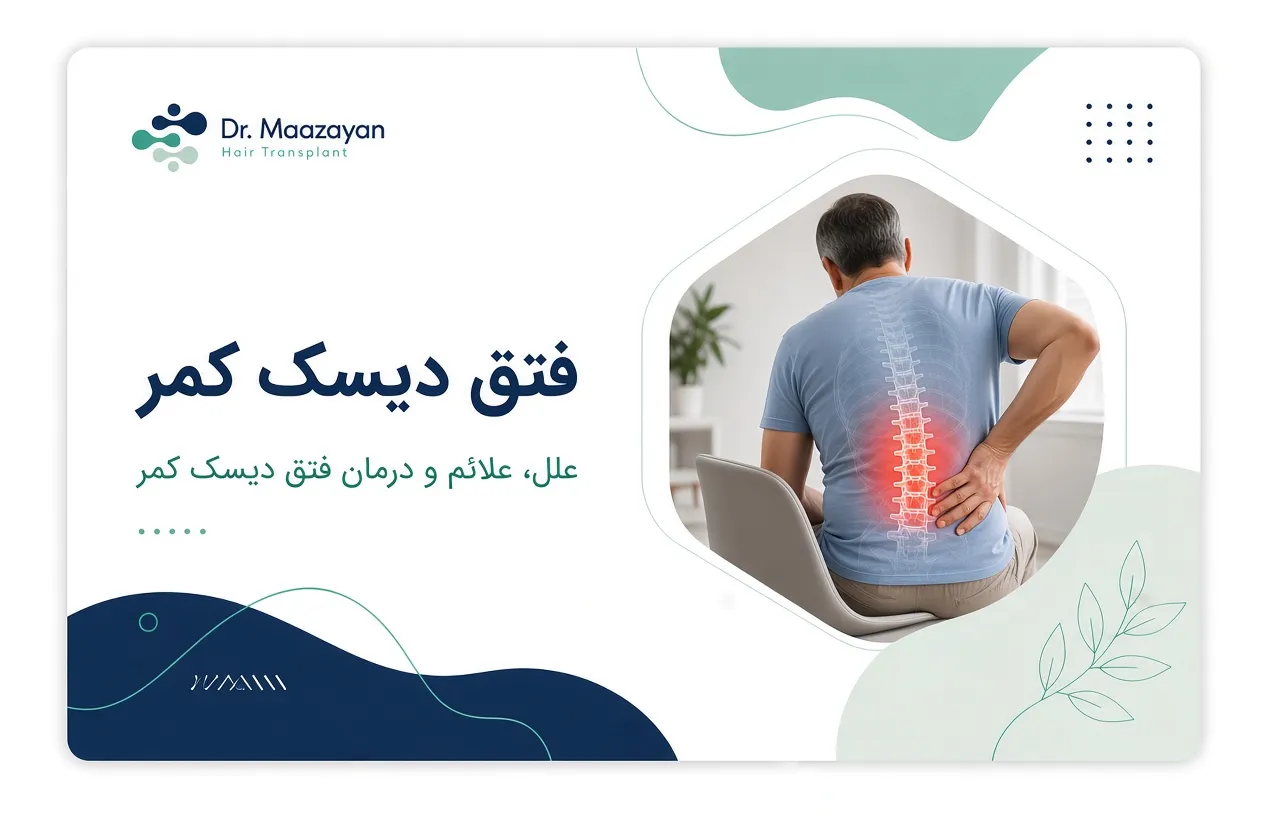 فتق دیسک کمر