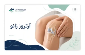 ارتروز زانو