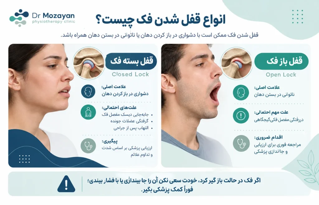 انواع قفل شدن فک