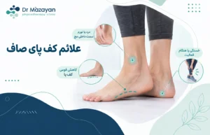 علائم کف پای صاف چیه؟