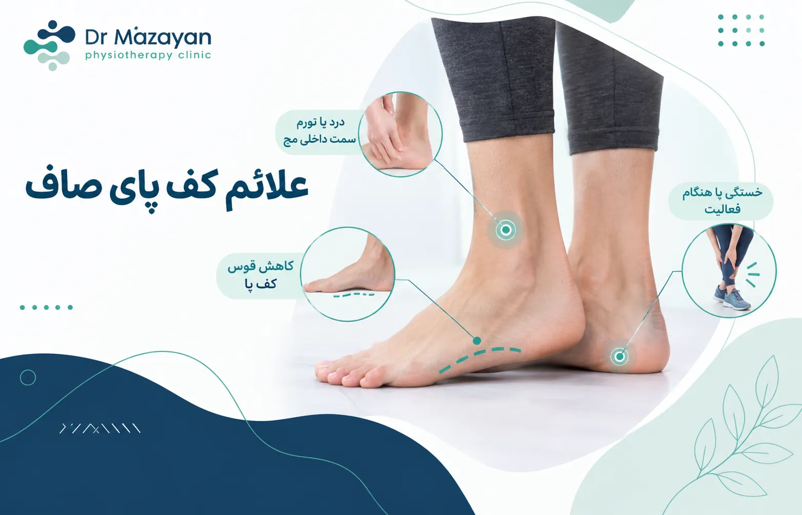 علائم کف پای صاف چیه؟