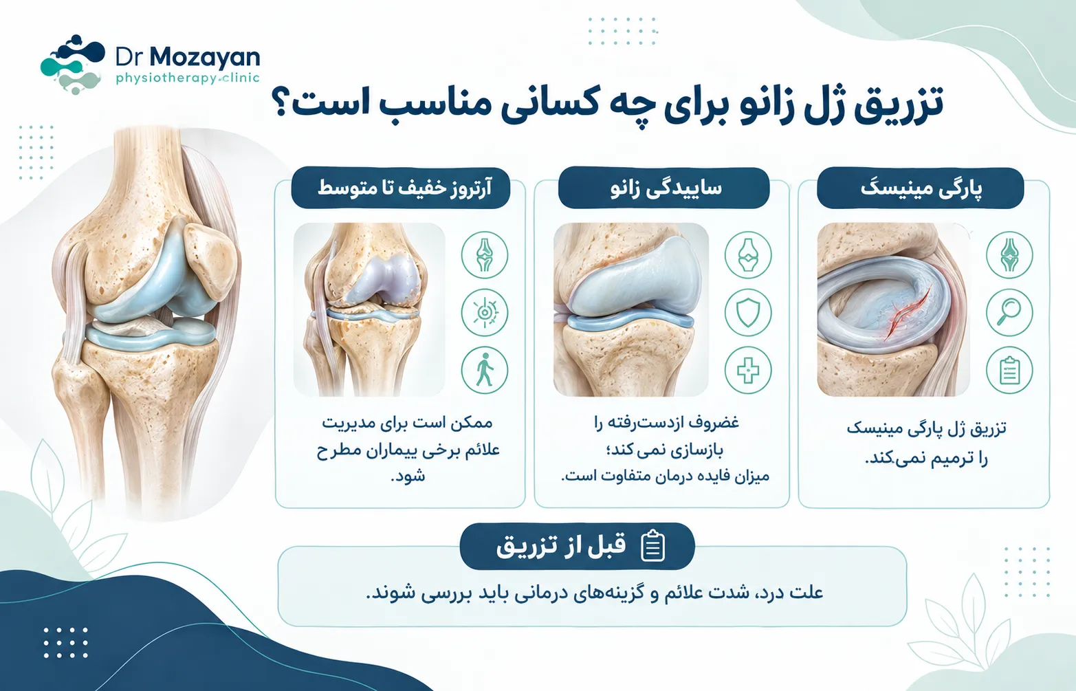 تزریق ژل زانو برای چه کسانی مناسب است