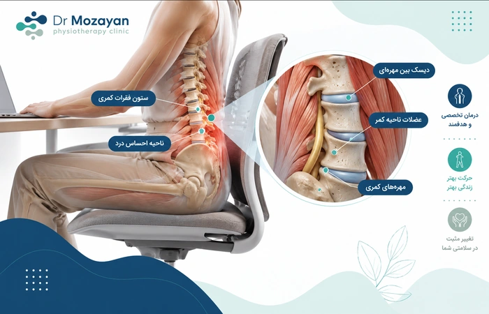 کمردرد بعد از نشستن طولانی