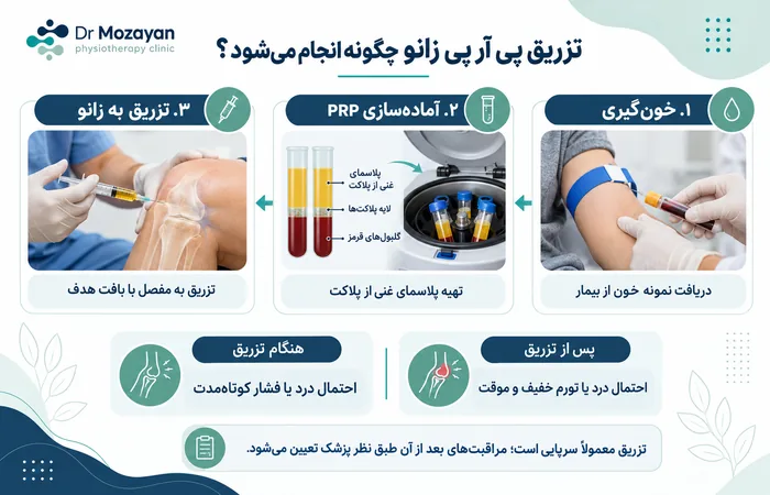 تزریق پی آر پی زانو
