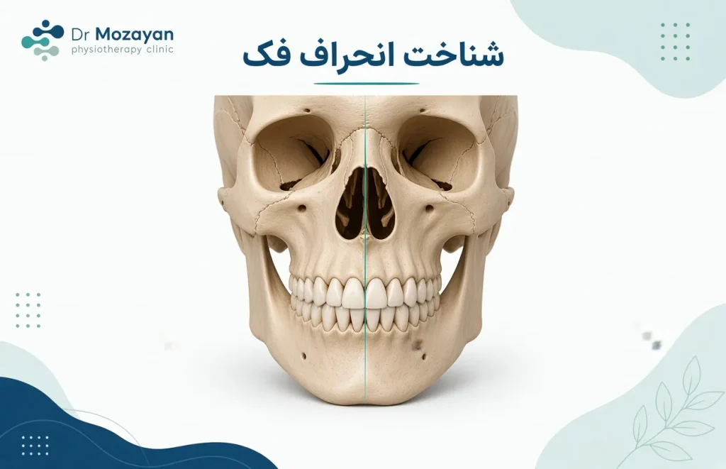 نحوه شناخت انحراف فک